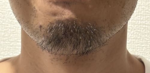 顎髭を生やしている人の写真
